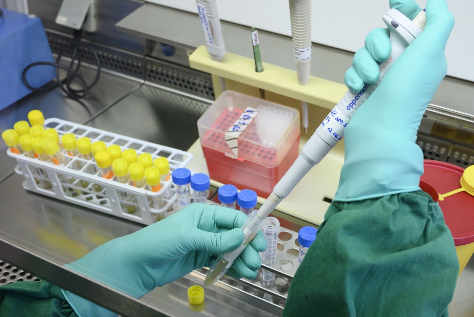 Nhân viên y tế xét nghiệm mẫu bệnh phẩm COVID-19 tại phòng thí nghiệm ở Stuttgart, miền Nam Đức ngày 2-3-2020. Ảnh: AFP/TTXVN