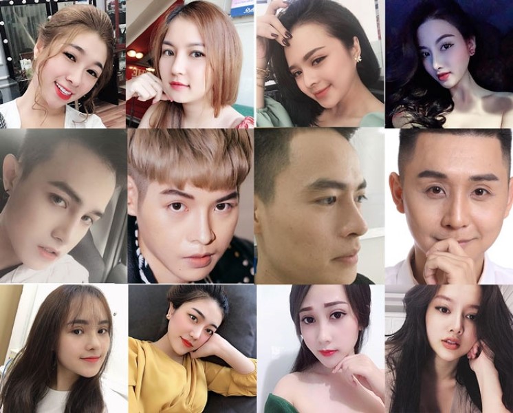 Nâng mũi có nguy hiểm và có hại về sau không?