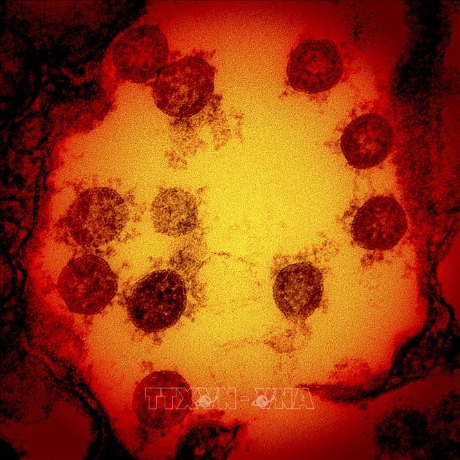 Ấn Độ ghi nhận ca thứ hai nhiễm biến thể XE của virus SARS-CoV-2 Hình ảnh dưới kính hiển vi do Viện quốc gia về bệnh truyền nhiễm và dị ứng (NIH/NIAID) cung cấp cho thấy virus SARS-CoV-2 được phân tách từ tế bào một bệnh nhân mắc COVID-19, ở Fort Detrick, Maryland (Mỹ). Ảnh minh họa: AFP/TTXVN