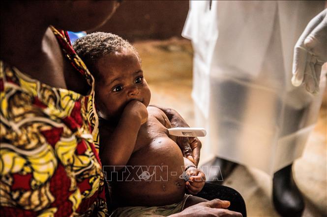 Bệnh nhân mắc đậu mùa khỉ được điều trị tại trung tâm cách ly ở Zomea Kaka thuộc vùng Lobaya, CH Trung Phi, ngày 18-10-2018. Ảnh: AFP/ TTXVN