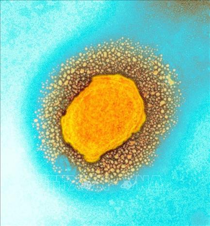 WHO: Bệnh đậu mùa khỉ đã lan ra hơn 20 quốc gia Hình ảnh virus đậu mùa khỉ dưới kính hiển vi điện tử. Ảnh: Cơ quan an ninh y tế Anh/TTXVN
