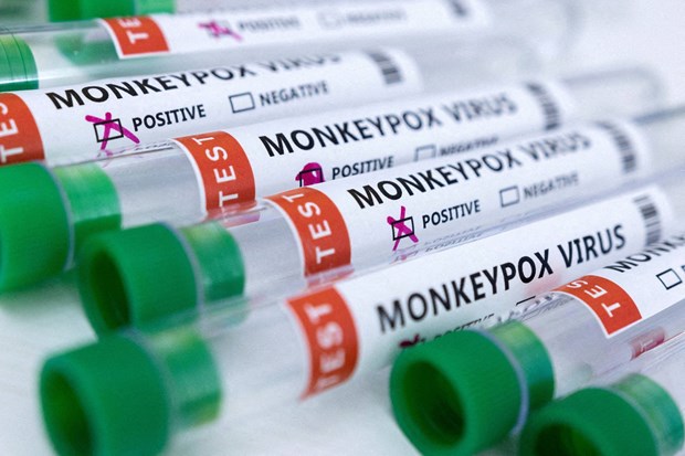 Xét nghiệm bệnh đậu mùa khỉ. (Nguồn: Reuters)