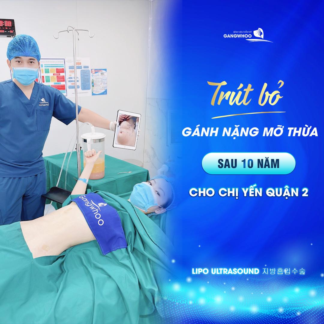 Khách hàng thực hiện hút mỡ bụng Lipo Ultrasound tại Gangwhoo.