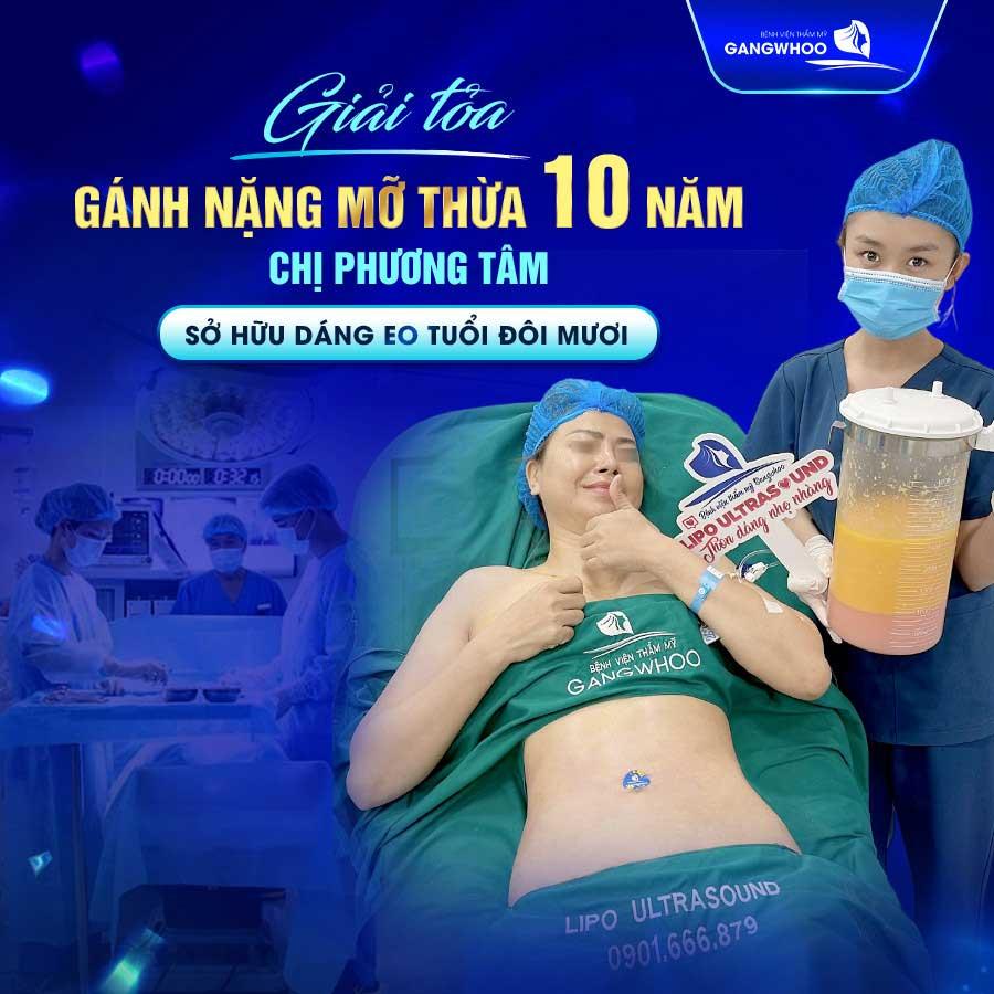 Chị khách lấy lại vóc dáng sau khi giảm mỡ tại Gangwhoo.