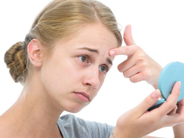 Học tập căng thẳng là nguyên nhân gây mụn tuổi dậy thì.