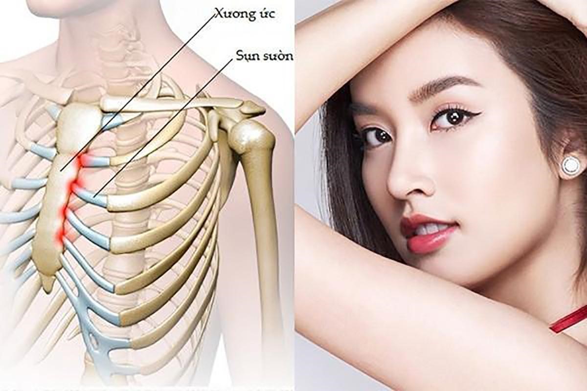 Nâng mũi sụn sườn - Giải pháp tái cấu trúc mũi ổn định lâu dài