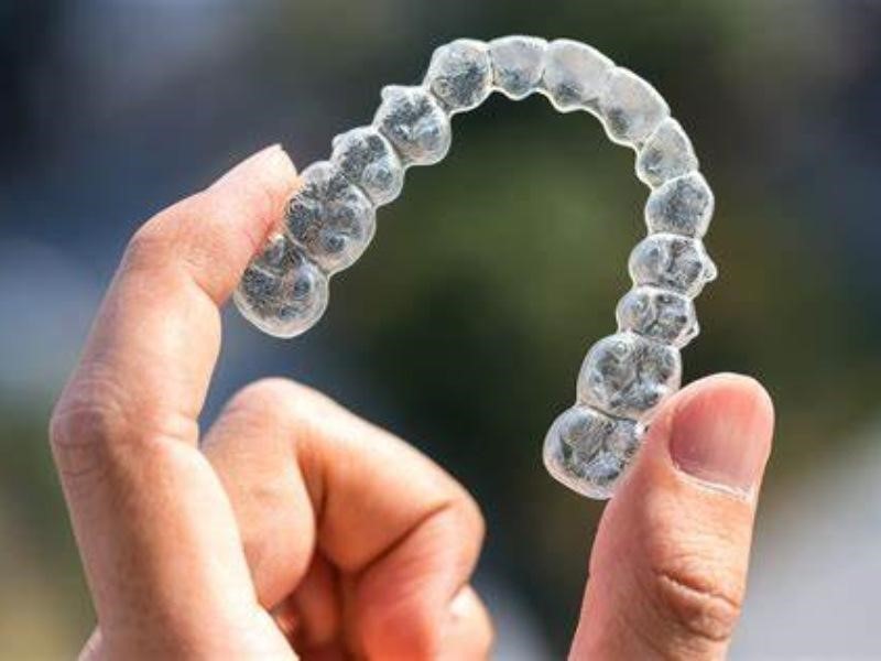 Niềng răng trong suốt là phương pháp thẩm mỹ hiện đại, đem lại hiệu quả bền vững
