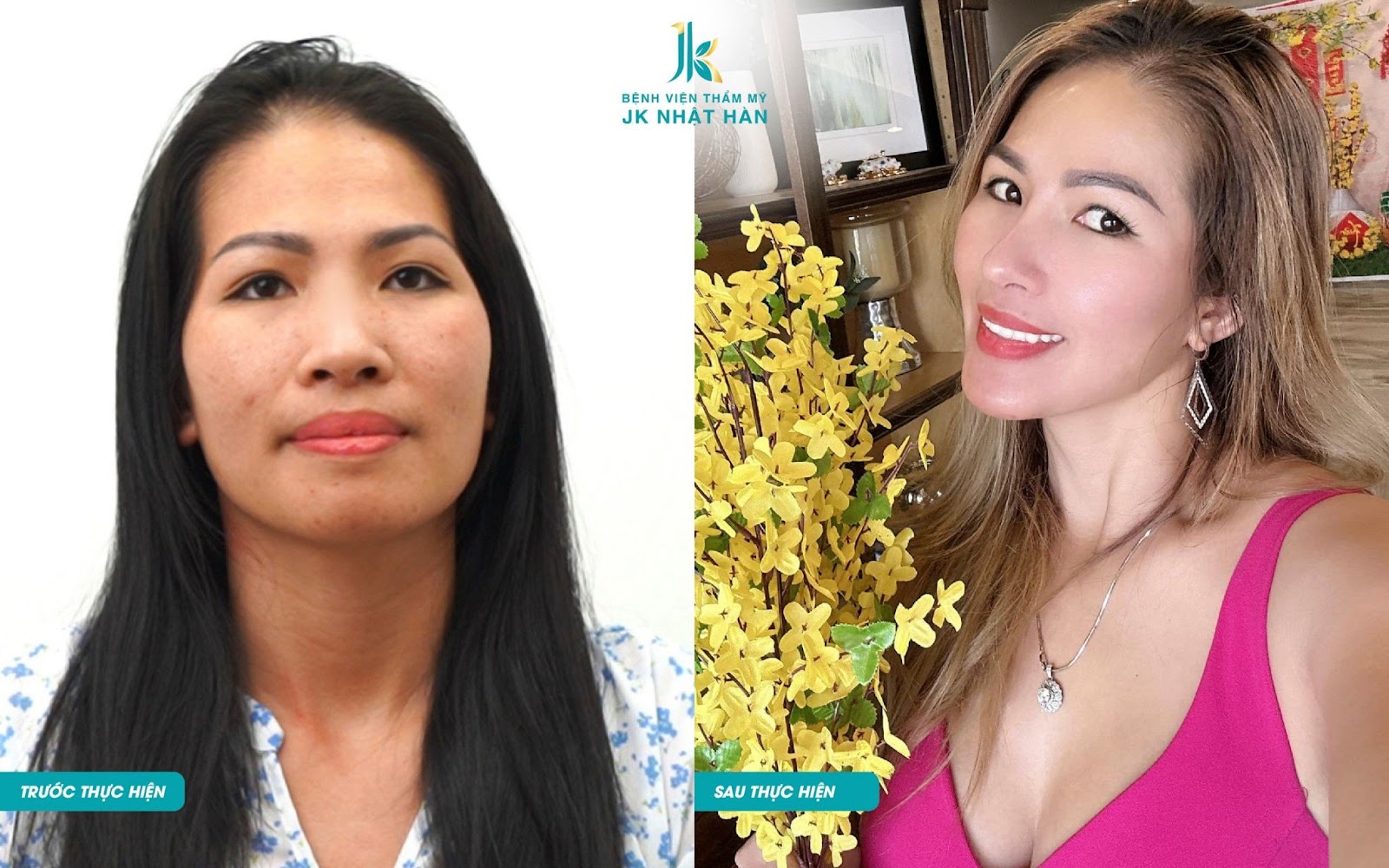 Bệnh viện JK Nhật Hàn - cái tâm của người làm nghề thẩm mỹ