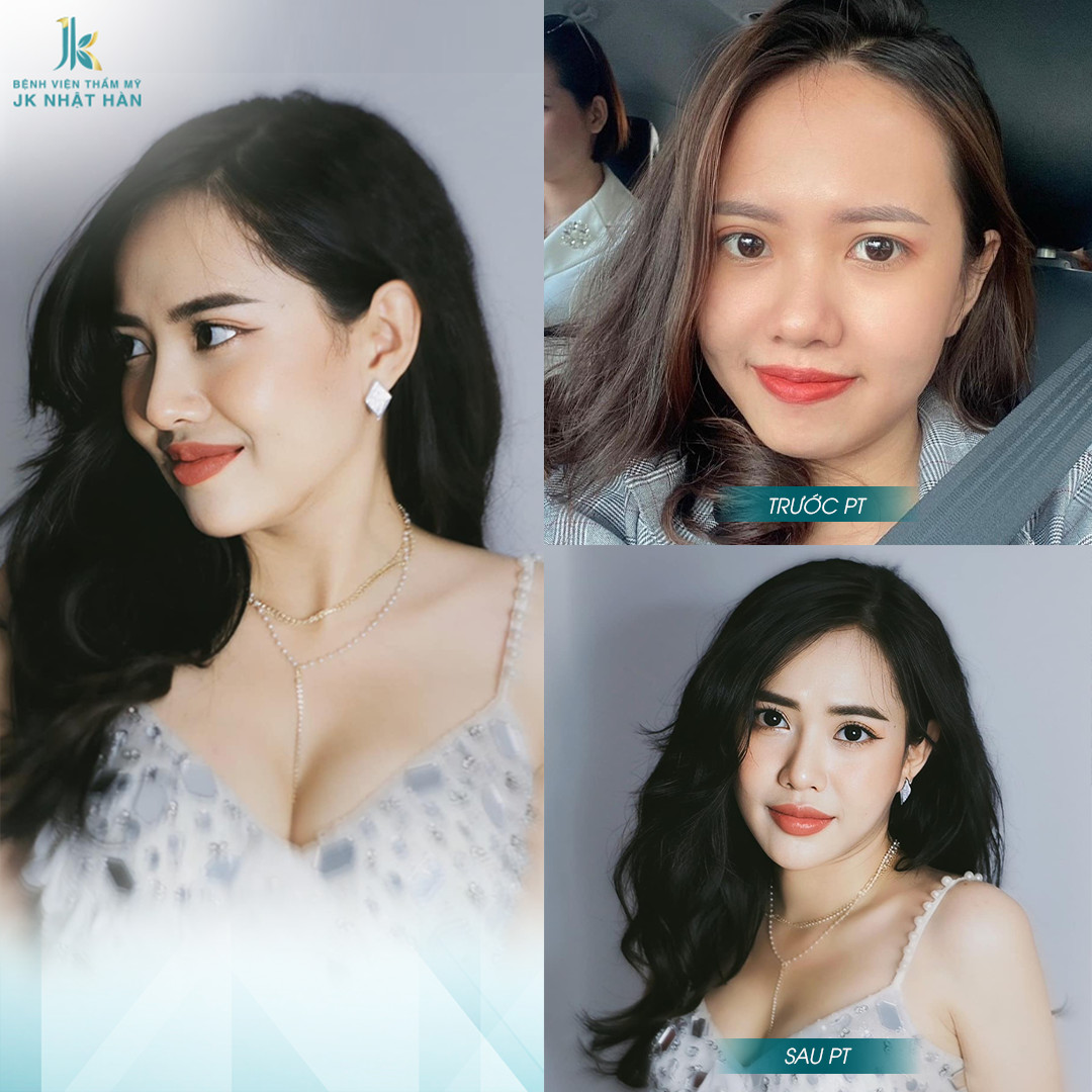 Bệnh viện JK Nhật Hàn - cái tâm của người làm nghề thẩm mỹ