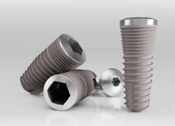 Trồng răng implant có đau không? Các loại trụ răng implant hiện nay