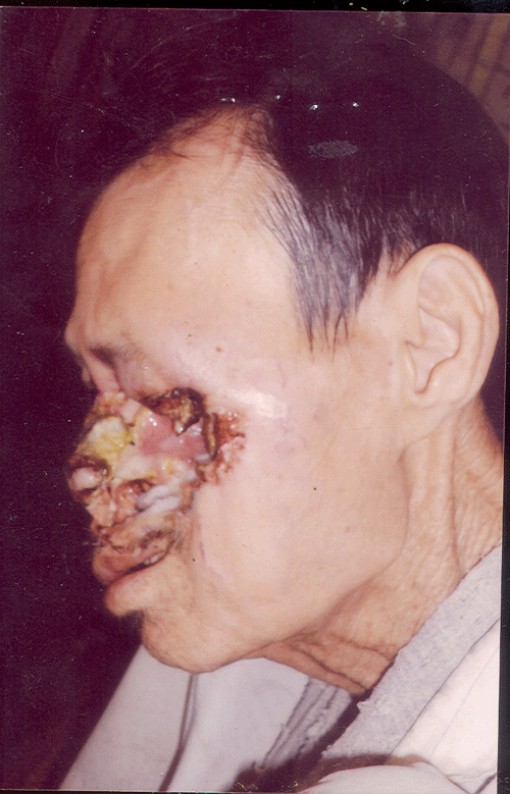 Hãy chia sẻ cùng ông Nho