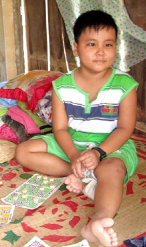 Một bé trai có khối u não cần giúp đỡ