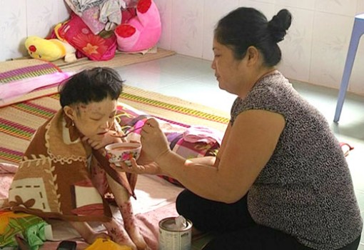 Một trường hợp cần sự chia sẻ