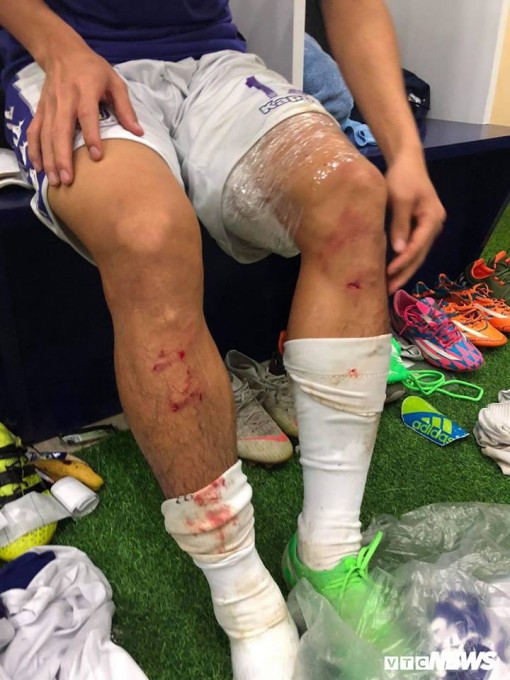 VFF cấm thi đấu 4 trận với Quế Ngọc Hải