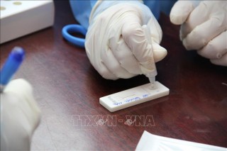 Ngày 27-10-2021, Việt Nam ghi nhận 4.411 ca nhiễm mới SARS-CoV-2; tăng so với ngày trước đó