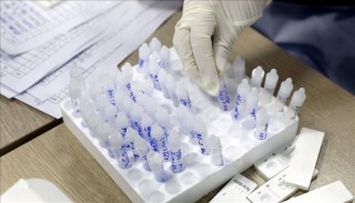 Tạm dừng yêu cầu xét nghiệm SARS-CoV-2 khi nhập cảnh Việt Nam từ ngày 15-5-2022