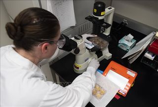 Vai trò quan trọng của kháng thể IgA chống virus SAR-CoV-2 Vai trò quan trọng của kháng thể IgA chống virus SAR-CoV-2