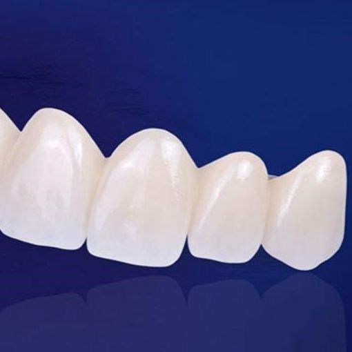 Răng sứ cercon - Ưu điểm vượt trội cả thẩm mỹ lẫn ăn nhai