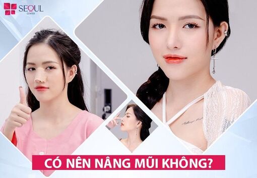 Có nên nâng mũi không? 4 Điều cấm kỵ cần biết khi nâng mũi