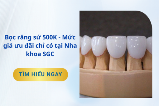 Bọc răng sứ 500K - Mức giá ưu đãi chỉ có tại Nha khoa SGC