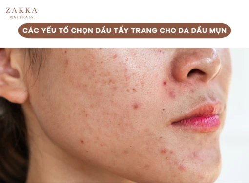 Review dầu tẩy trang sạch sâu dễ nhũ hóa