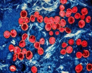 Pháp phát hiện ca nhiễm biến thể mới của virus đậu mùa khỉ