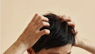 Ngứa da đầu kéo dài: Làm sao để chọn dầu gội trị ngứa phù hợp
